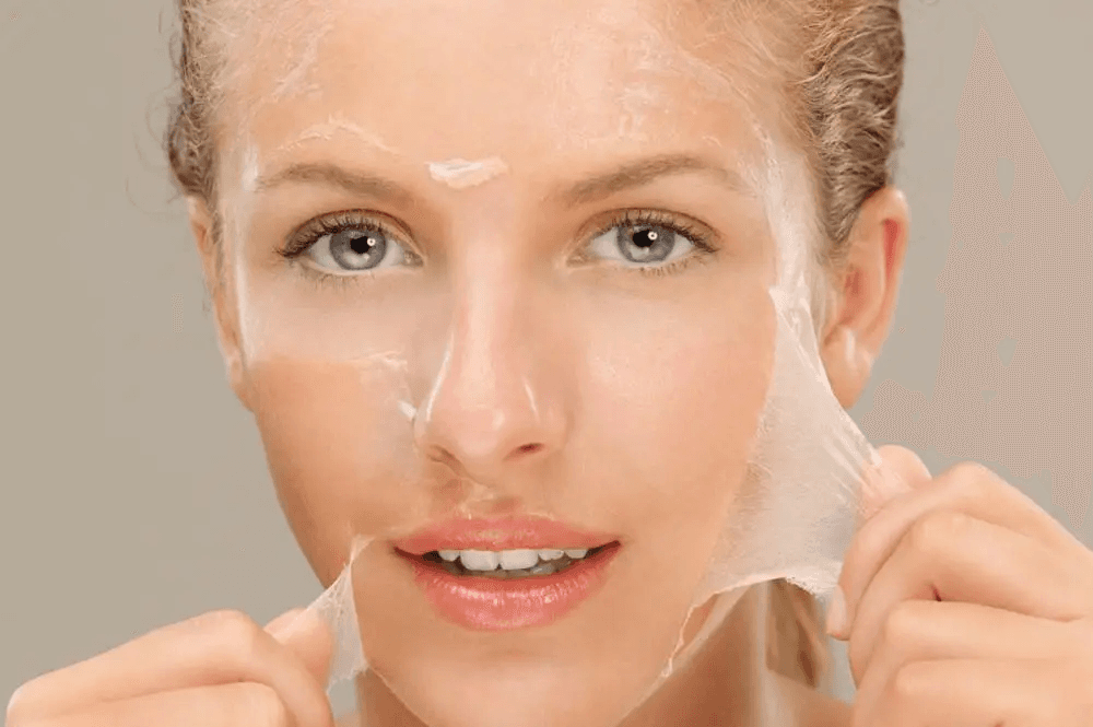 Chemical Peels and Facials