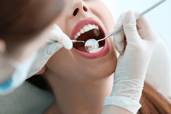 General Dental Checkup