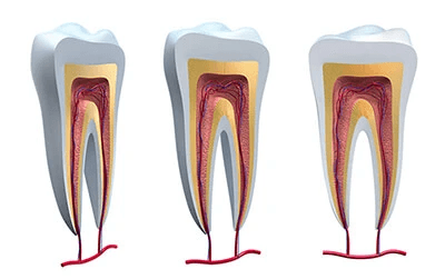 Root Canal & Oral Surgery